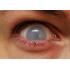 Контактные линзы-склеры белые катаракта