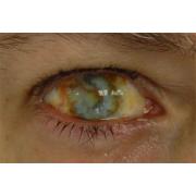 Контактные линзы-склеры Зомби глаз